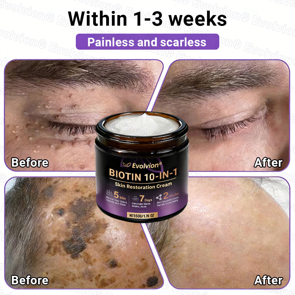 Made and Shipped from UK ✨Evolvion® Biotin 10-in-1 Skin Restoration Cream 👑