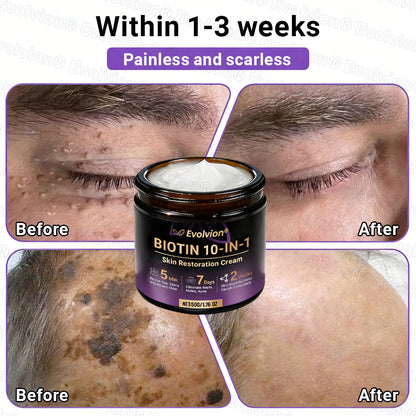 Made and Shipped from UK ✨Evolvion® Biotin 10-in-1 Skin Restoration Cream 👑