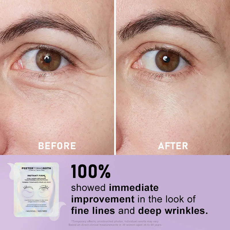 🐦Last 3 Hours: 70% OFF🔥 - Collagen Eye Patches (8 Pairs) with Niacinamide & Hyaluronic Acid for Firming, Hydration, & Brightening