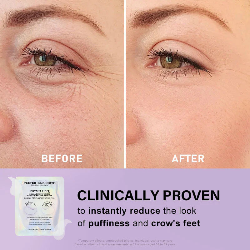 🐦Last 3 Hours: 70% OFF🔥 - Collagen Eye Patches (8 Pairs) with Niacinamide & Hyaluronic Acid for Firming, Hydration, & Brightening