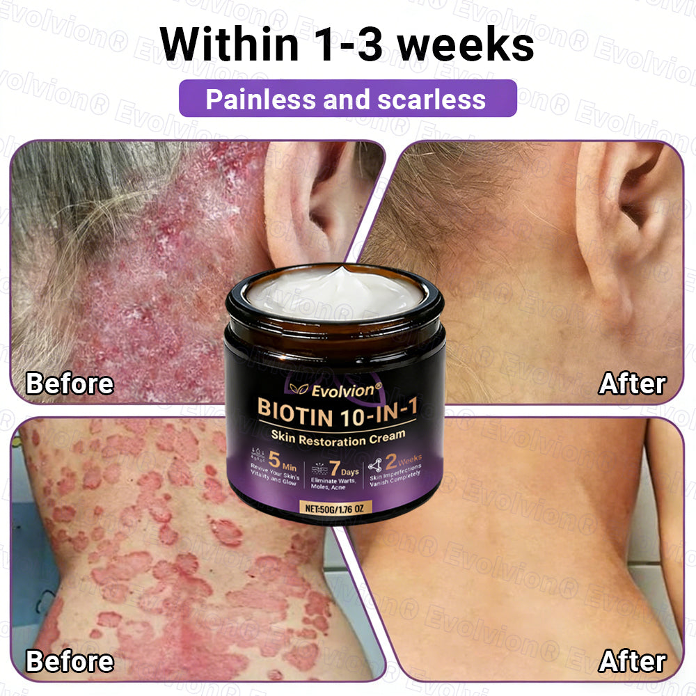 Made and Shipped from UK ✨Evolvion® Biotin 10-in-1 Skin Restoration Cream 👑