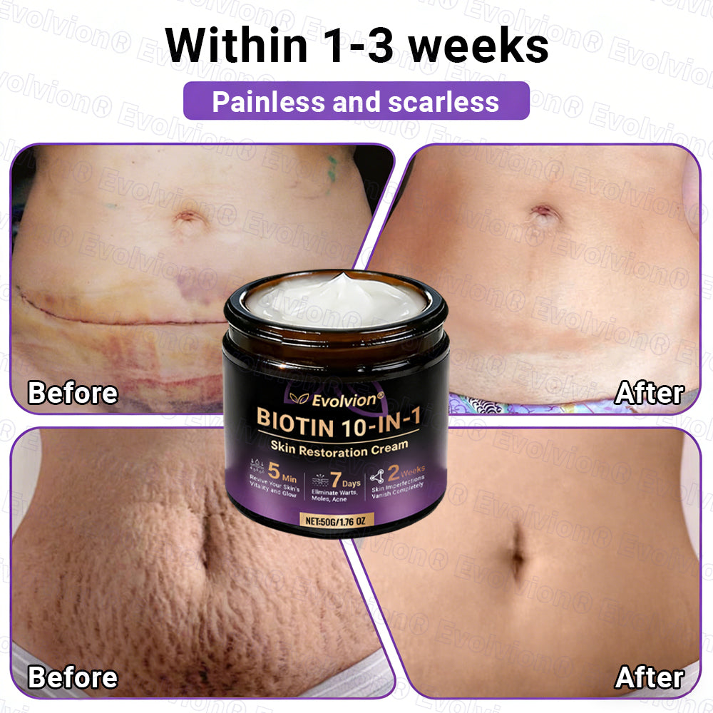 Made and Shipped from UK ✨Evolvion® Biotin 10-in-1 Skin Restoration Cream 👑