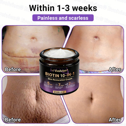 Made and Shipped from UK ✨Evolvion® Biotin 10-in-1 Skin Restoration Cream 👑