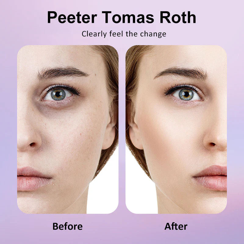 🐦Last 3 Hours: 70% OFF🔥 - Collagen Eye Patches (8 Pairs) with Niacinamide & Hyaluronic Acid for Firming, Hydration, & Brightening