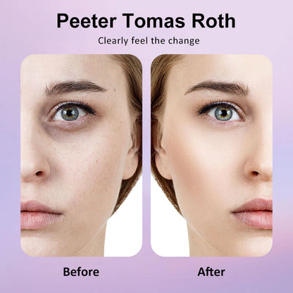 🐦Last 3 Hours: 70% OFF🔥 - Collagen Eye Patches (8 Pairs) with Niacinamide & Hyaluronic Acid for Firming, Hydration, & Brightening