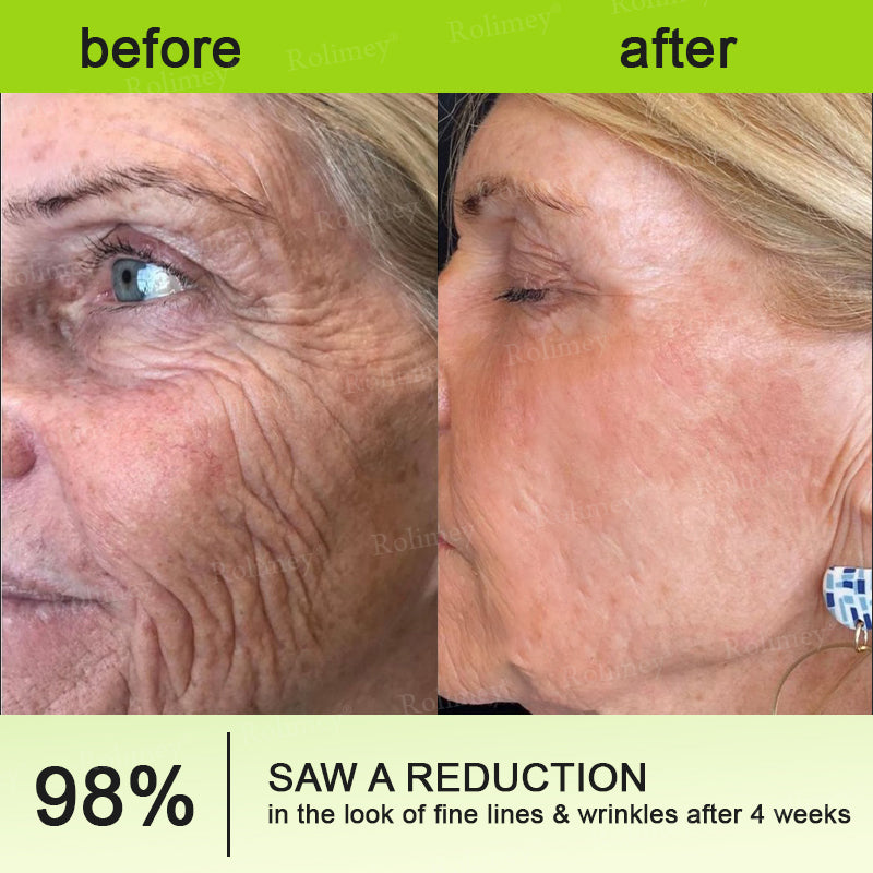 💞Made and shipped from the USA 💫Rolimey® Botox & Vita-A Retinol Shot Wrinkle-Lift Tightening cream - Last Day Promotion 70% OFF