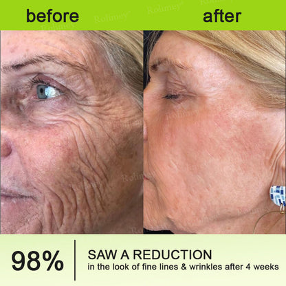 💞Made and shipped from the USA 💫Rolimey® Botox & Vita-A Retinol Shot Wrinkle-Lift Tightening cream - Last Day Promotion 70% OFF