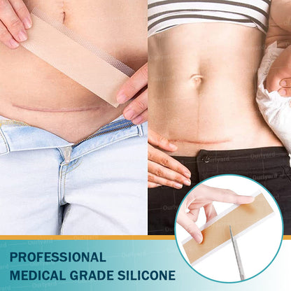 ✅Official Store |Ourlyard® Hyaluronic Acid Nano Microneedle Repair Tape🗽🎉(Treatment of old and new scars, reduction of surgical scars, stretch marks, keloids, acne, burns, warts, dermatomes and varicose veins)