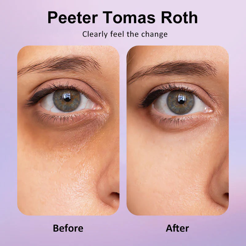 🐦Last 3 Hours: 70% OFF🔥 - Collagen Eye Patches (8 Pairs) with Niacinamide & Hyaluronic Acid for Firming, Hydration, & Brightening