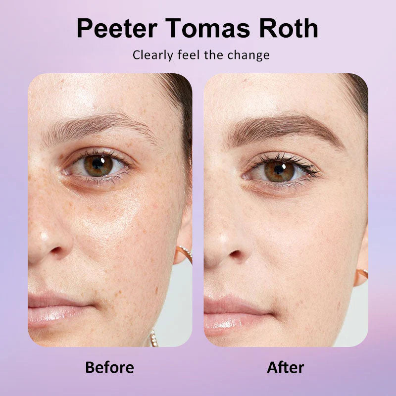 🐦Last 3 Hours: 70% OFF🔥 - Collagen Eye Patches (8 Pairs) with Niacinamide & Hyaluronic Acid for Firming, Hydration, & Brightening