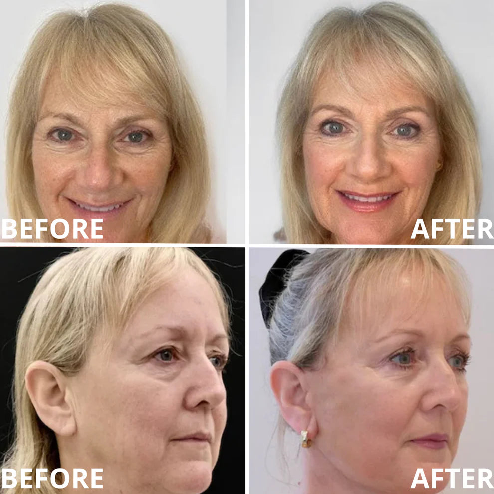 🍍[Zvoevo® Official] 50% OFF ✨ Calcium Multi Balm | Anti-Aging, Firming & Wrinkle Care