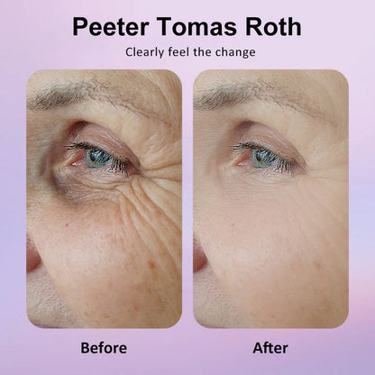 🐦Last 3 Hours: 70% OFF🔥 - Collagen Eye Patches (8 Pairs) with Niacinamide & Hyaluronic Acid for Firming, Hydration, & Brightening