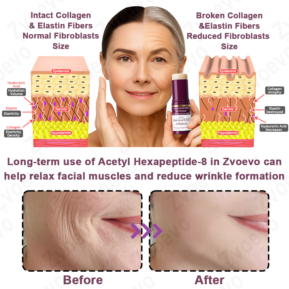 💧✅ Official Store: Zvoevo® Calcium Collagen Repair Lip Balm 👩‍⚕️ TGA Certified (For wrinkles and fine lines, smoothing nasolabial folds and neck lines, softening crow's feet)