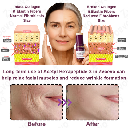 💧✅ Official Store: Zvoevo® Calcium Collagen Repair Lip Balm 👩‍⚕️ TGA Certified (For wrinkles and fine lines, smoothing nasolabial folds and neck lines, softening crow's feet)