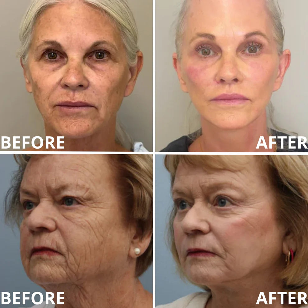 🍍[Zvoevo® Official] 50% OFF ✨ Calcium Multi Balm | Anti-Aging, Firming & Wrinkle Care