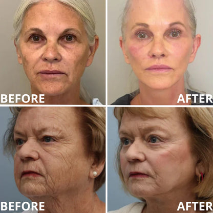 🍍[Zvoevo® Official] 50% OFF ✨ Calcium Multi Balm | Anti-Aging, Firming & Wrinkle Care