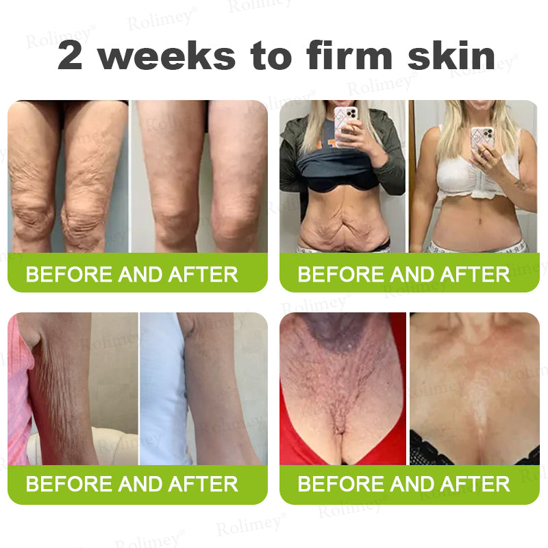 💞Made and shipped from the USA 💫Rolimey® Botox & Vita-A Retinol Shot Wrinkle-Lift Tightening cream - Last Day Promotion 70% OFF