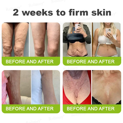 💞Made and shipped from the USA 💫Rolimey® Botox & Vita-A Retinol Shot Wrinkle-Lift Tightening cream - Last Day Promotion 70% OFF