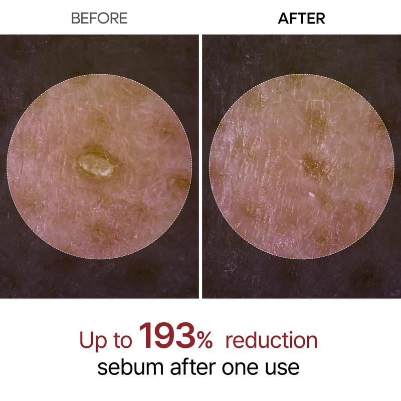 AQA✨✨Last Day 50%OFF:Peel Shot Glow White Rice Peeling Ampoule