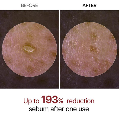 AQA✨✨Last Day 50%OFF:Peel Shot Glow White Rice Peeling Ampoule