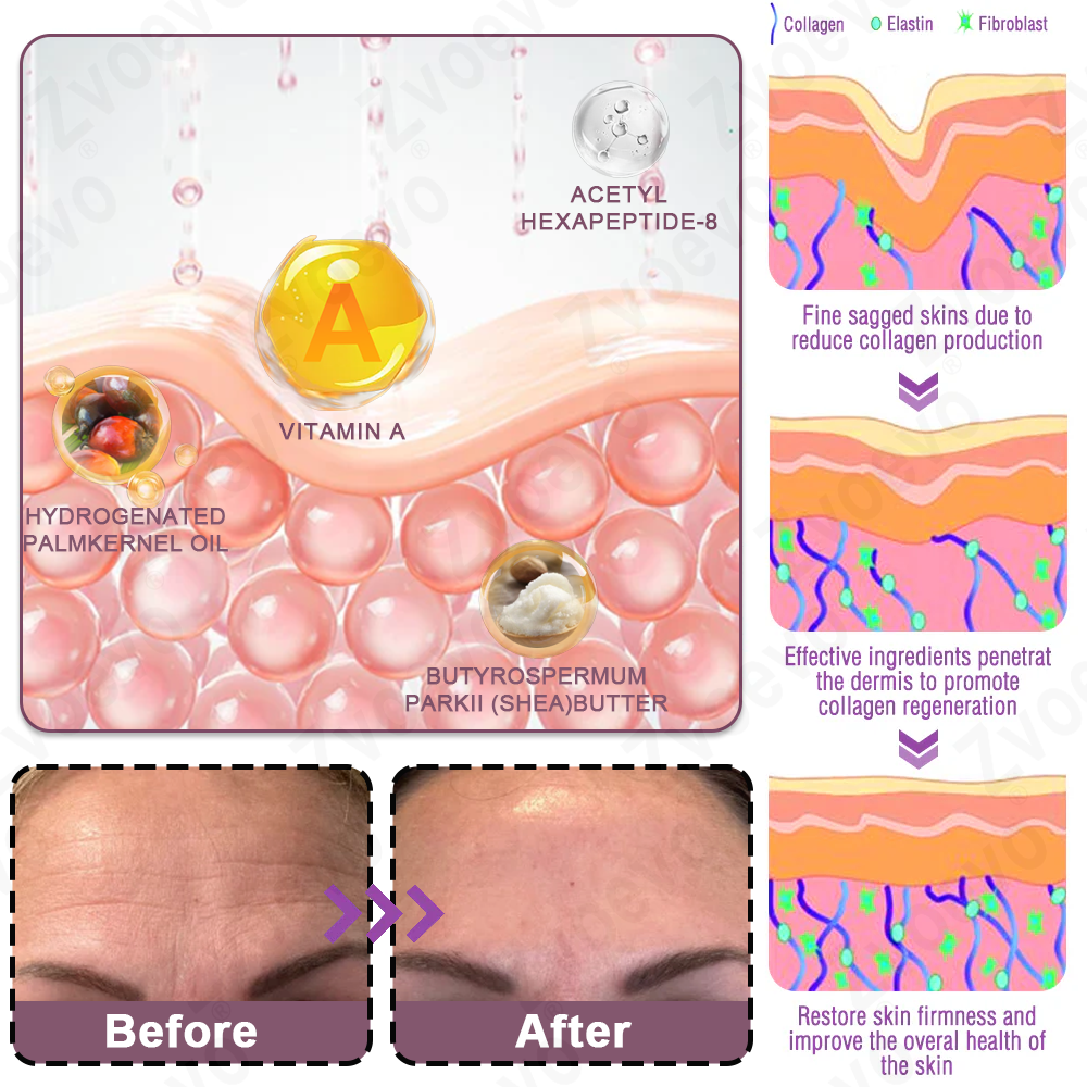 💧✅ Official Store: Zvoevo® Calcium Collagen Repair Lip Balm 👩‍⚕️ TGA Certified (For wrinkles and fine lines, smoothing nasolabial folds and neck lines, softening crow's feet)