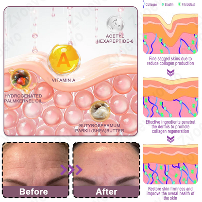 💧✅ Official Store: Zvoevo® Calcium Collagen Repair Lip Balm 👩‍⚕️ TGA Certified (For wrinkles and fine lines, smoothing nasolabial folds and neck lines, softening crow's feet)