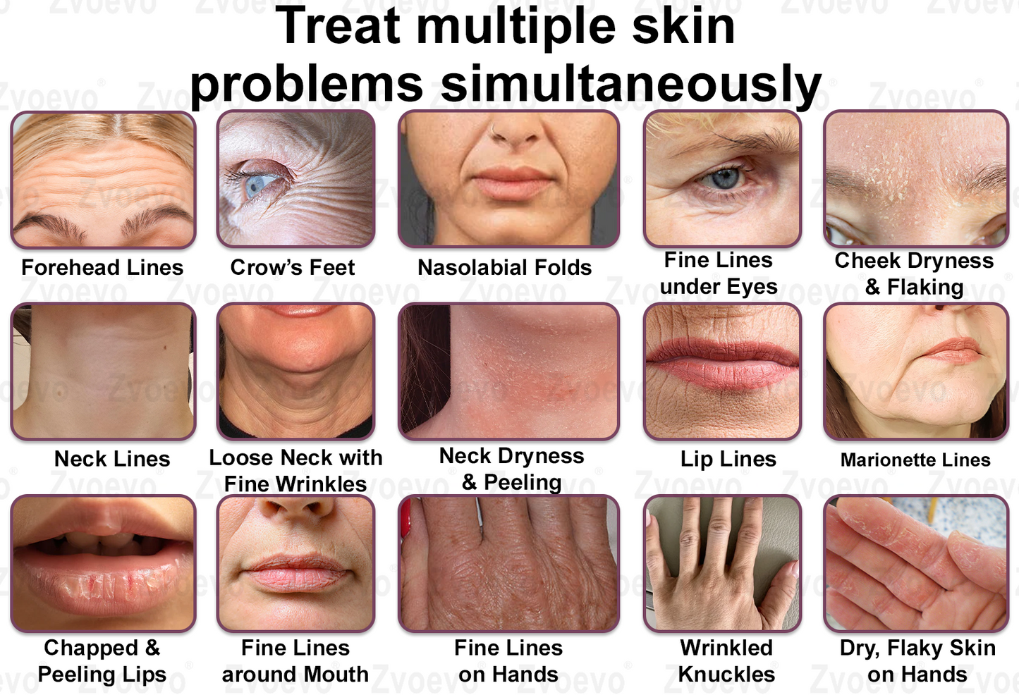 💧✅ Official Store: Zvoevo® Calcium Collagen Repair Lip Balm 👩‍⚕️ TGA Certified (For wrinkles and fine lines, smoothing nasolabial folds and neck lines, softening crow's feet)