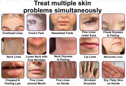 💧✅ Official Store: Zvoevo® Calcium Collagen Repair Lip Balm 👩‍⚕️ TGA Certified (For wrinkles and fine lines, smoothing nasolabial folds and neck lines, softening crow's feet)