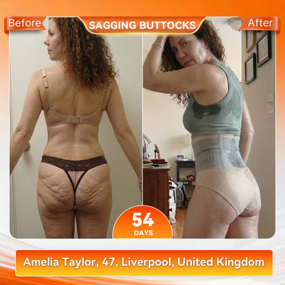 🫧🐆𝐌𝐨𝐫𝐢𝐧𝐠𝐚 & 𝐁𝐞𝐫𝐛𝐞𝐫𝐢𝐧𝐞 4‑In‑1 Micro‑Particle Sculpting & Fat‑Burn Shorts