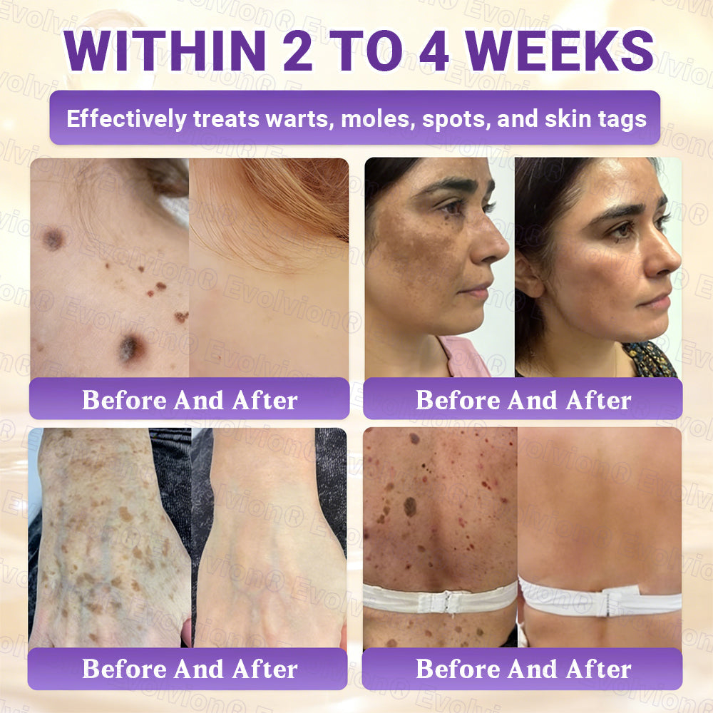 Made and Shipped from UK ✨Evolvion® Biotin 10-in-1 Skin Restoration Cream 👑