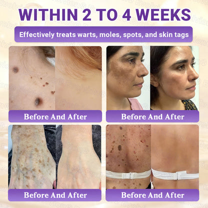 Made and Shipped from UK ✨Evolvion® Biotin 10-in-1 Skin Restoration Cream 👑