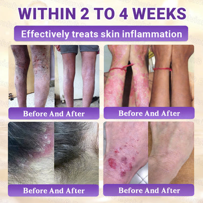 Made and Shipped from UK ✨Evolvion® Biotin 10-in-1 Skin Restoration Cream 👑
