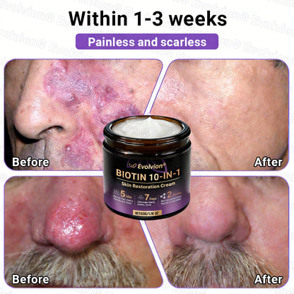 Made and Shipped from UK ✨Evolvion® Biotin 10-in-1 Skin Restoration Cream 👑