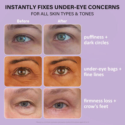 🐦Last 3 Hours: 70% OFF🔥 - Collagen Eye Patches (8 Pairs) with Niacinamide & Hyaluronic Acid for Firming, Hydration, & Brightening