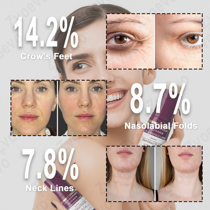 💧✅ Official Store: Zvoevo® Calcium Collagen Repair Lip Balm 👩‍⚕️ TGA Certified (For wrinkles and fine lines, smoothing nasolabial folds and neck lines, softening crow's feet)