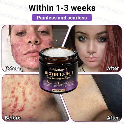 Made and Shipped from UK ✨Evolvion® Biotin 10-in-1 Skin Restoration Cream 👑