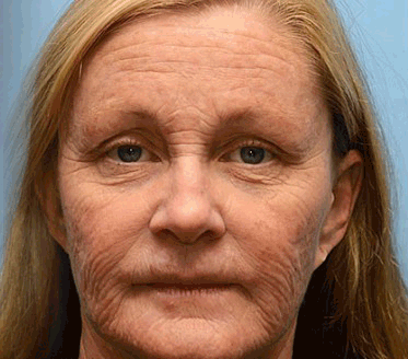 💞Made and shipped from the USA 💫Rolimey® Botox & Vita-A Retinol Shot Wrinkle-Lift Tightening cream - Last Day Promotion 70% OFF