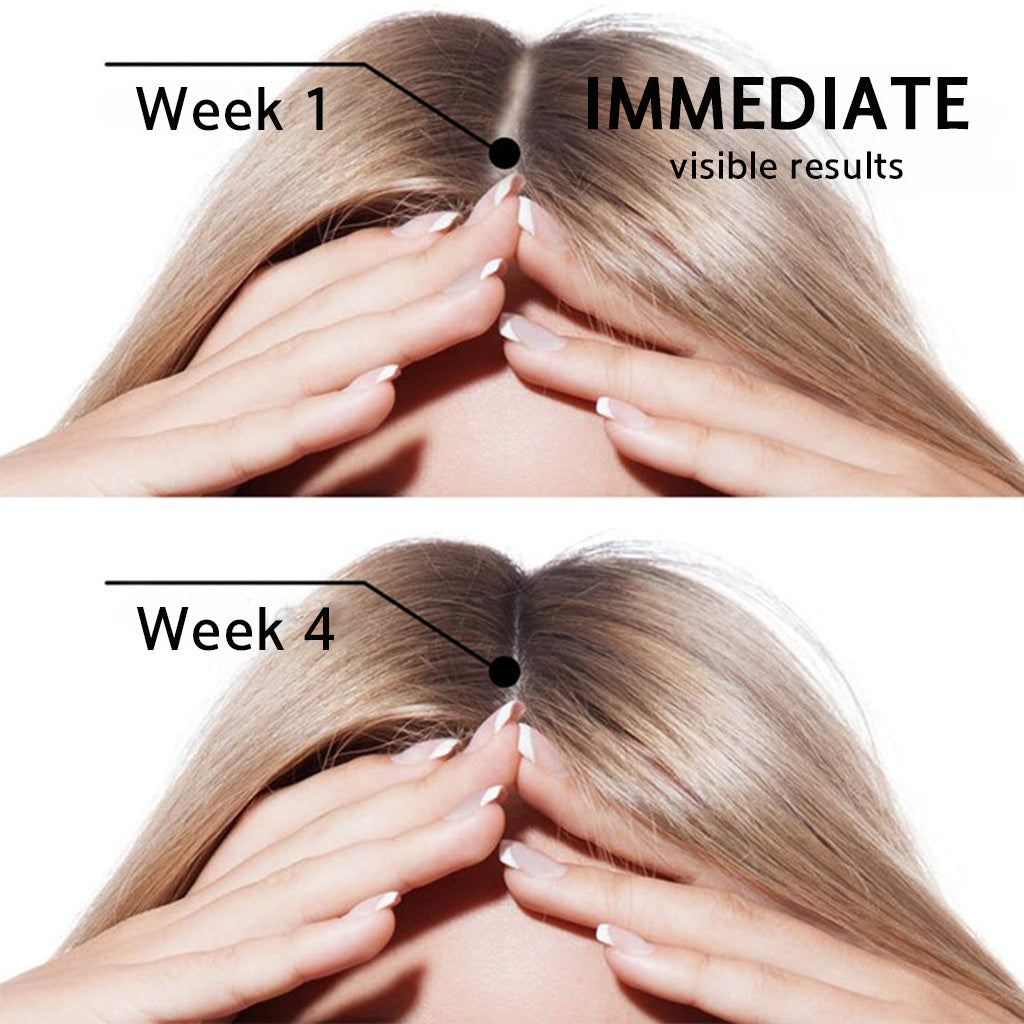 🌿👨‍⚕️ Official AU Store 🇦🇺 | 🔥Rolimey® Highly Effective Biotin & Rosemary Hair Growth Serum — (🔥 Limited-Time Offer, ⏳ Last Day Promotion 50% OFF)