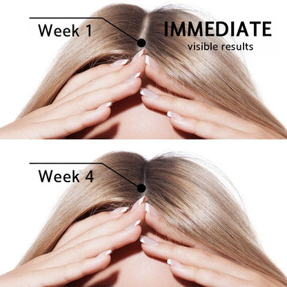 🌿👨‍⚕️ Official AU Store 🇦🇺 | 🔥Rolimey® Highly Effective Biotin & Rosemary Hair Growth Serum — (🔥 Limited-Time Offer, ⏳ Last Day Promotion 50% OFF)